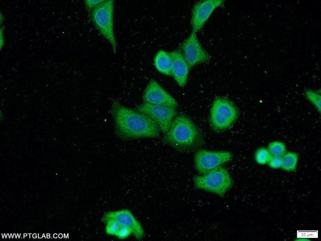 MKL1 Antibody in Immunocytochemistry (ICC/IF)