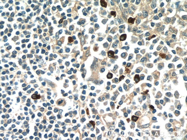 MKL1 Antibody in Immunohistochemistry (Paraffin) (IHC (P))