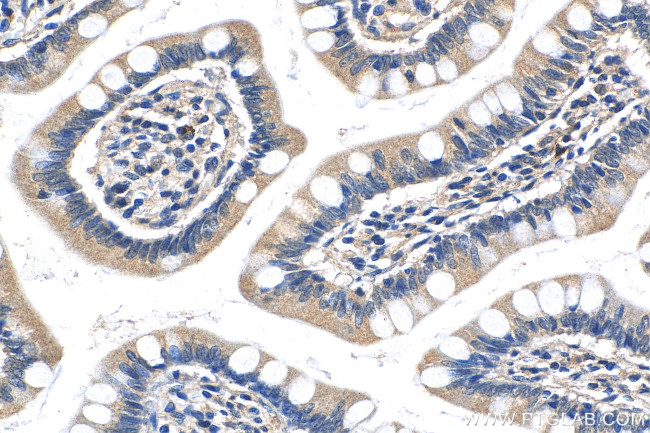 MKL1 Antibody in Immunohistochemistry (Paraffin) (IHC (P))