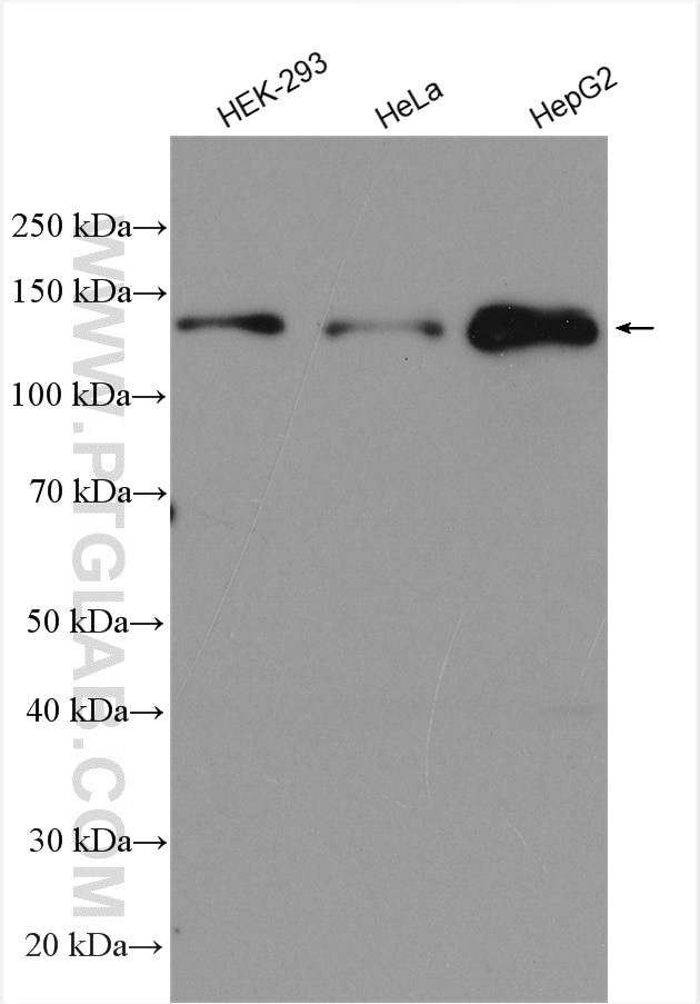 MKL1 Antibody in Western Blot (WB)