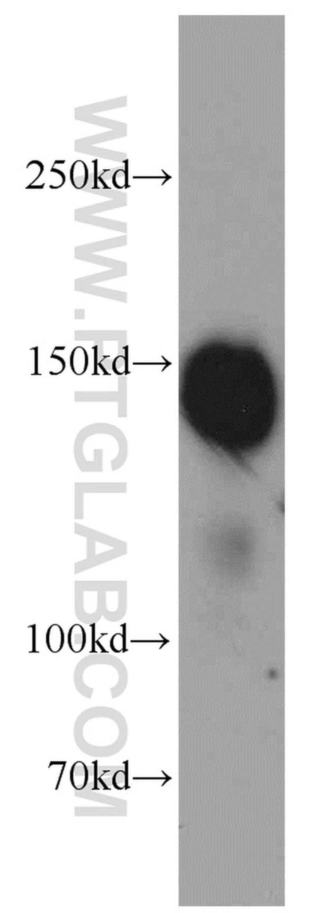 MKL1 Antibody in Western Blot (WB)