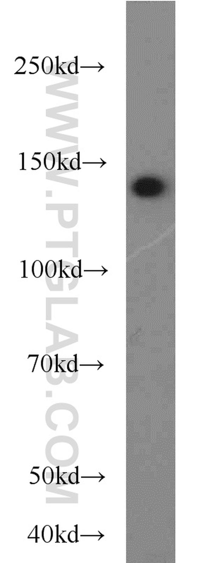 MKL1 Antibody in Western Blot (WB)