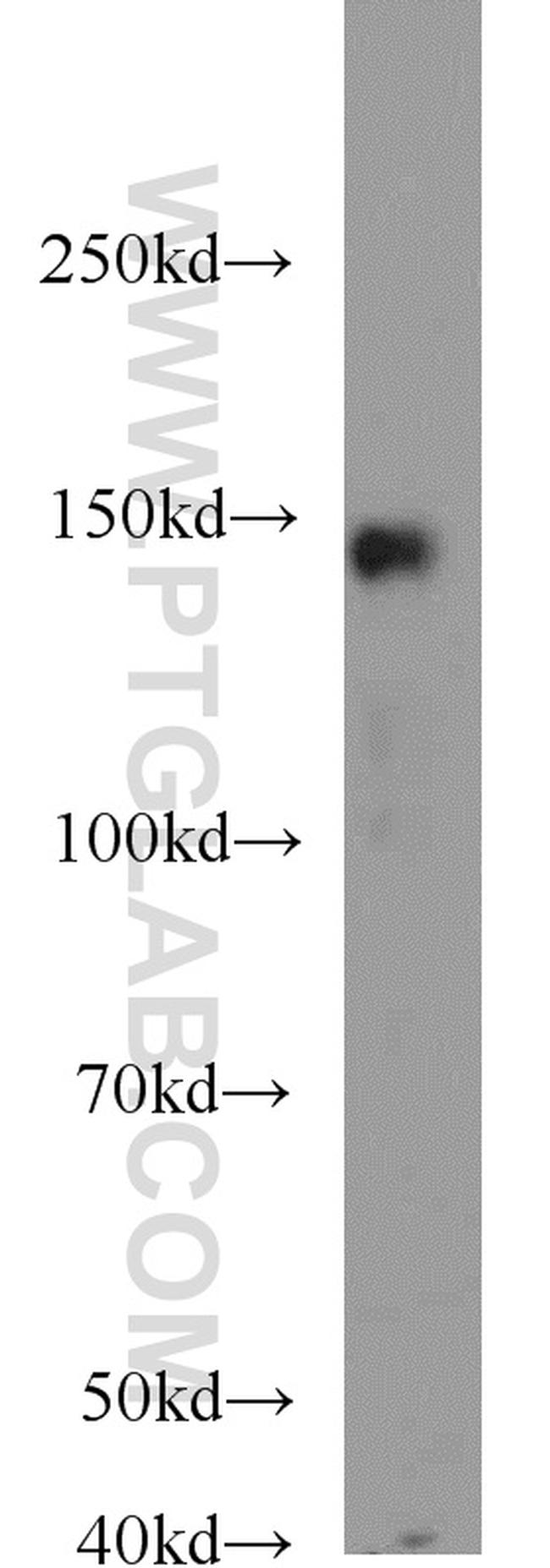 MKL1 Antibody in Western Blot (WB)