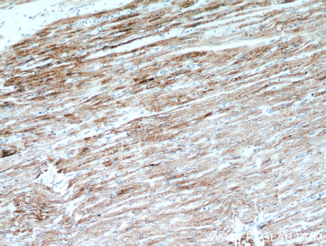 LRPPRC Antibody in Immunohistochemistry (Paraffin) (IHC (P))