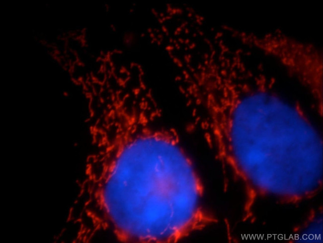 LRPPRC Antibody in Immunocytochemistry (ICC/IF)