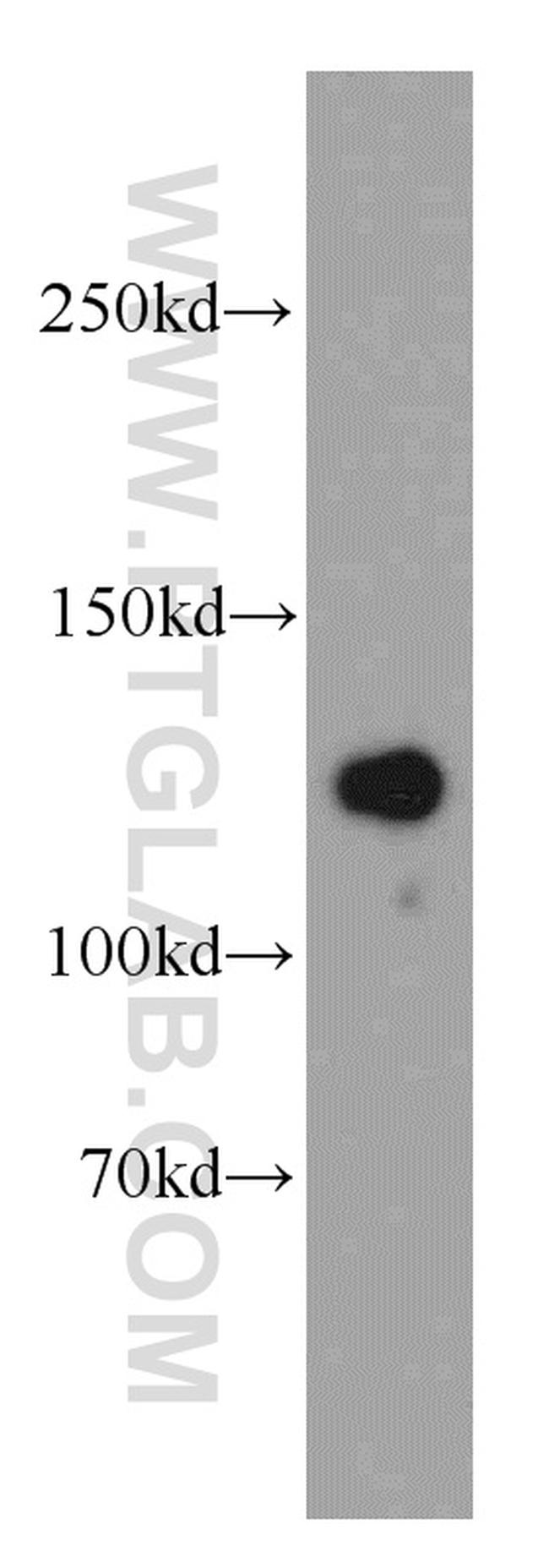 LRPPRC Antibody in Western Blot (WB)