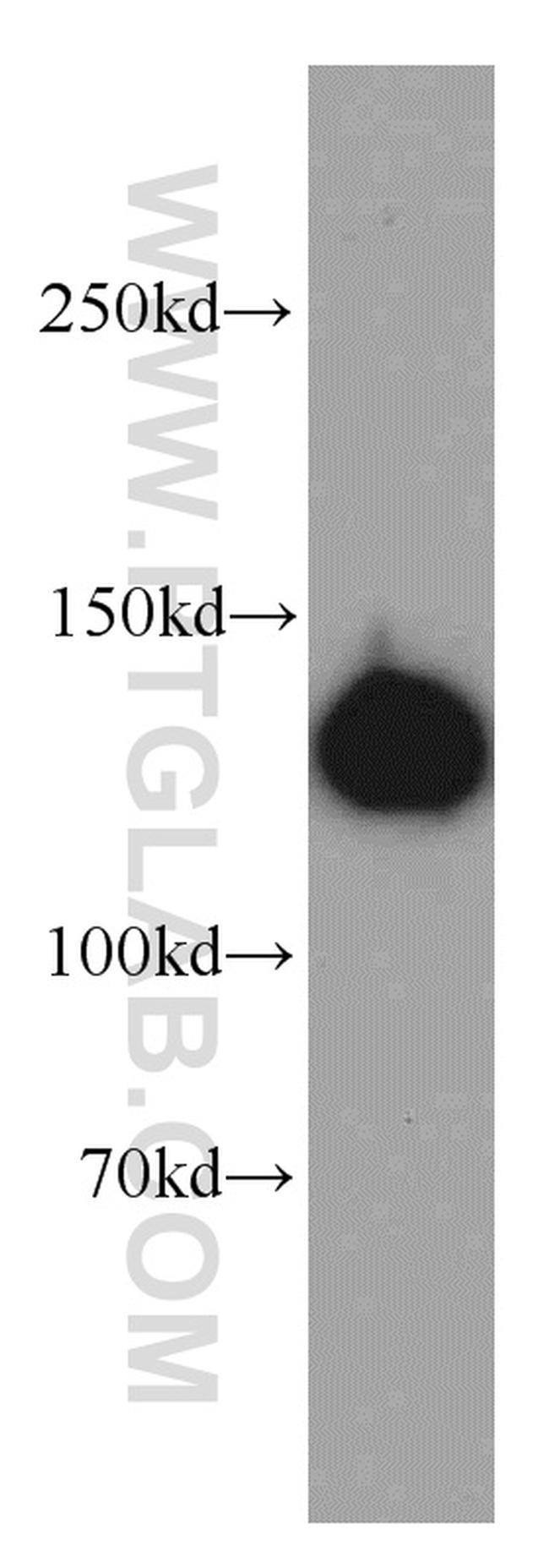 LRPPRC Antibody in Western Blot (WB)