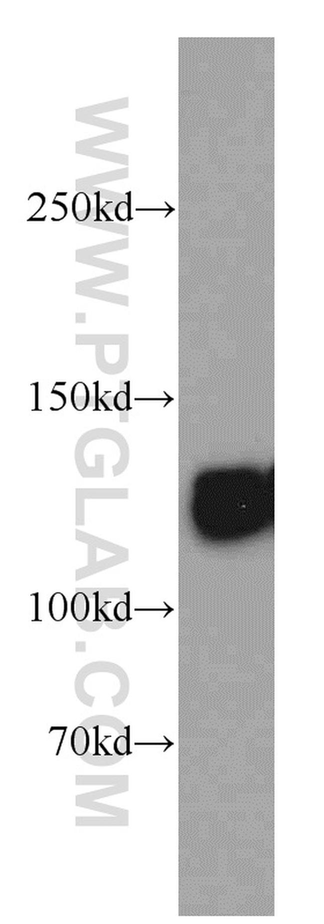 LRPPRC Antibody in Western Blot (WB)