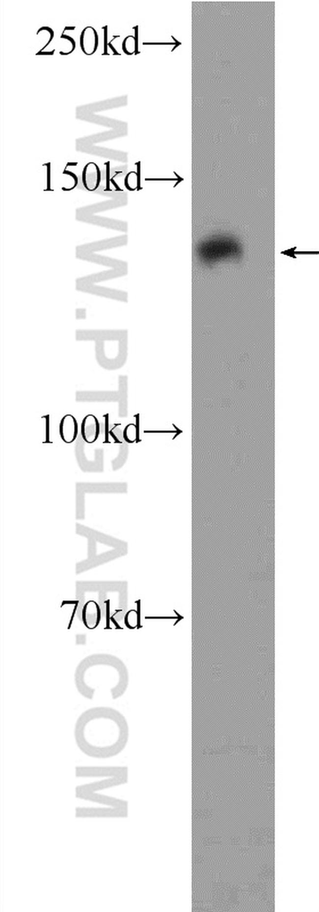 LRPPRC Antibody in Western Blot (WB)