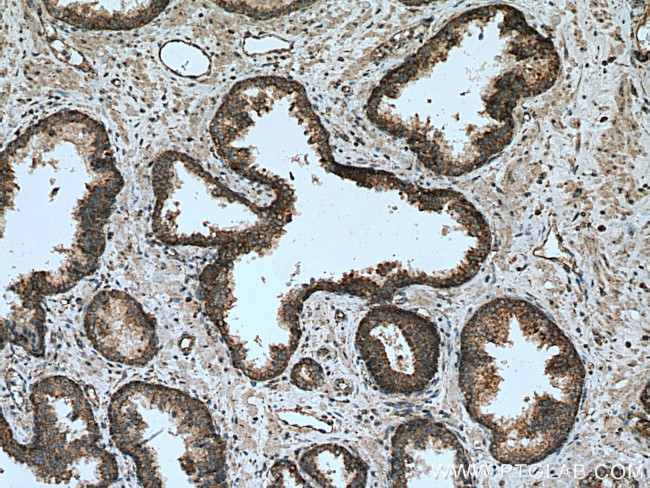 PPM2C Antibody in Immunohistochemistry (Paraffin) (IHC (P))