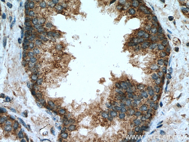 PPM2C Antibody in Immunohistochemistry (Paraffin) (IHC (P))