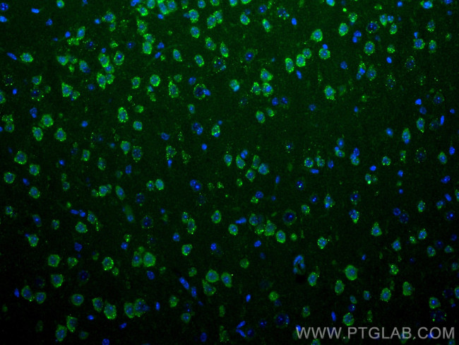 S1PR2 Antibody in Immunohistochemistry (PFA fixed) (IHC (PFA))