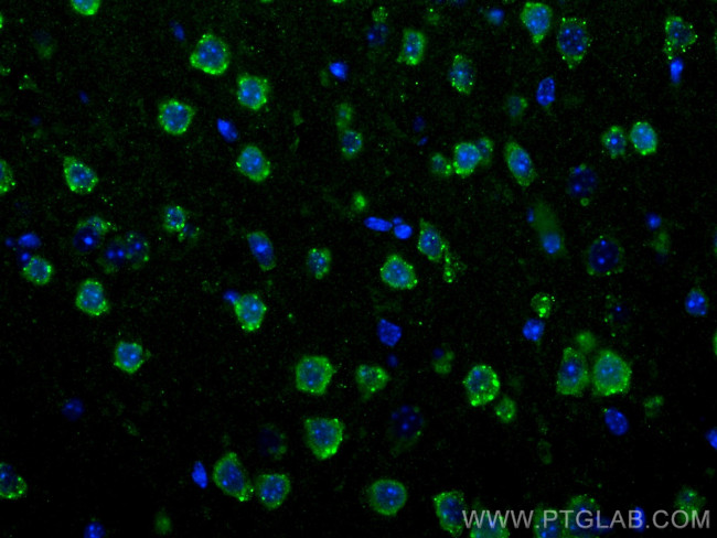 S1PR2 Antibody in Immunohistochemistry (PFA fixed) (IHC (PFA))