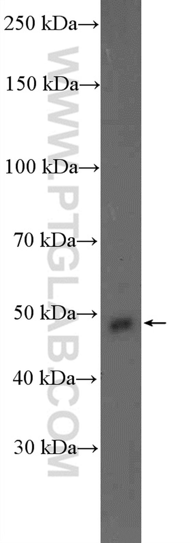 S1PR2 Antibody in Western Blot (WB)