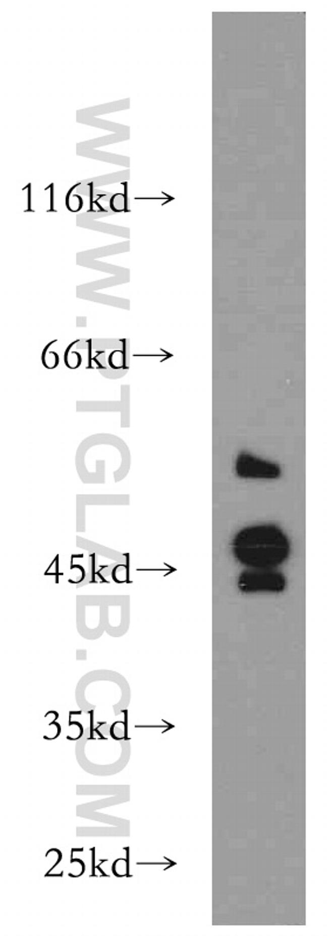 S1PR2 Antibody in Western Blot (WB)