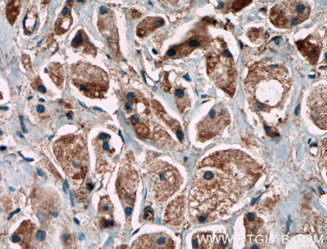 C11orf57 Antibody in Immunohistochemistry (Paraffin) (IHC (P))