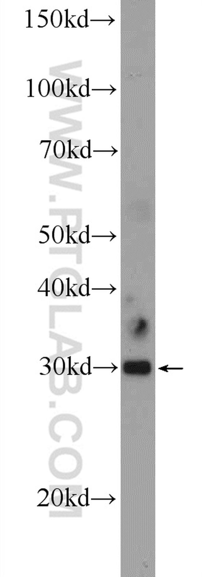 C11orf57 Antibody in Western Blot (WB)