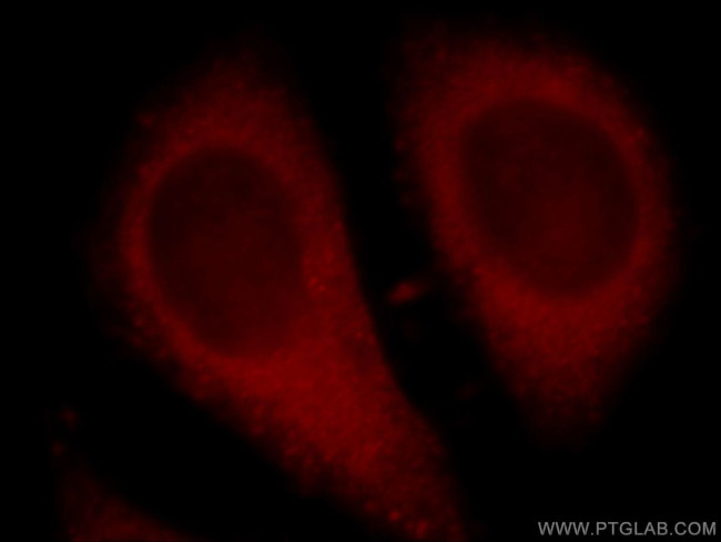 C13orf18 Antibody in Immunocytochemistry (ICC/IF)