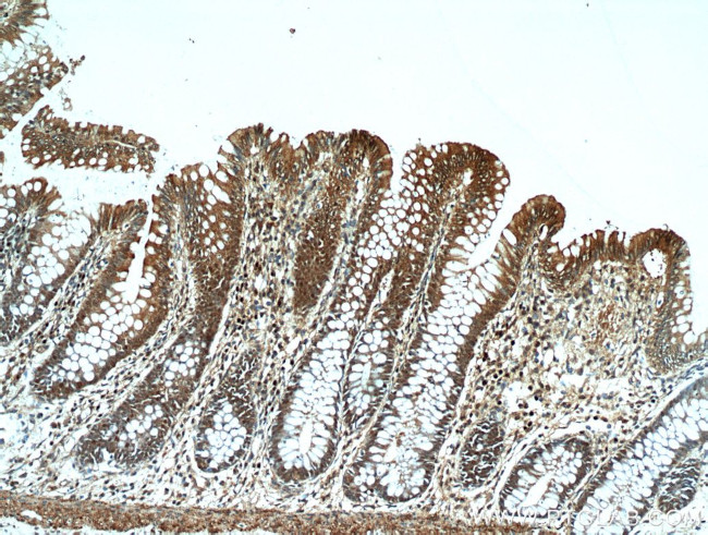 C13orf18 Antibody in Immunohistochemistry (Paraffin) (IHC (P))