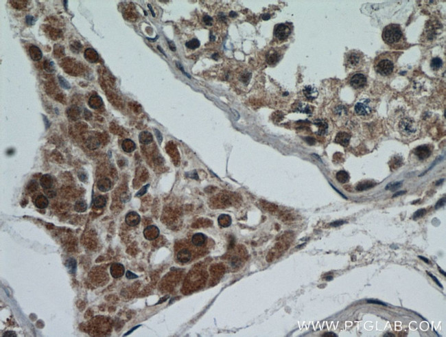 C13orf18 Antibody in Immunohistochemistry (Paraffin) (IHC (P))