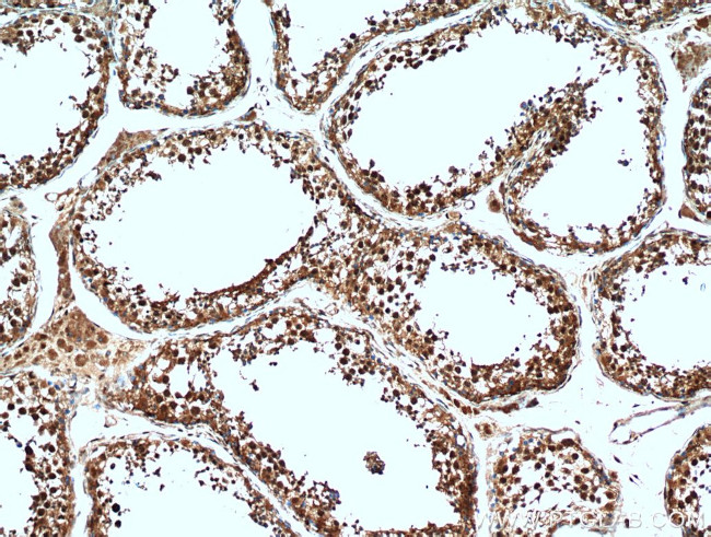 C13orf18 Antibody in Immunohistochemistry (Paraffin) (IHC (P))