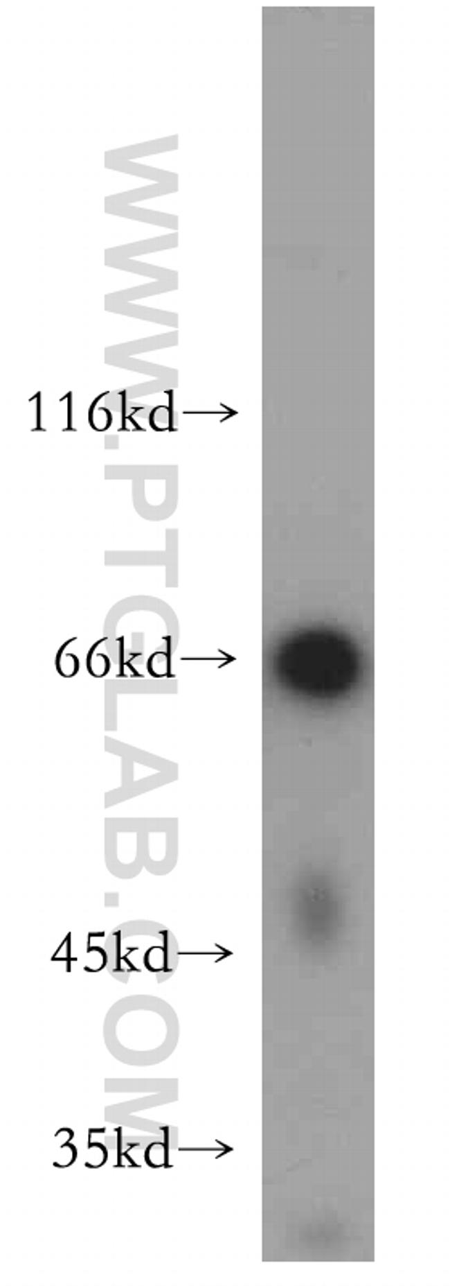 C13orf18 Antibody in Western Blot (WB)