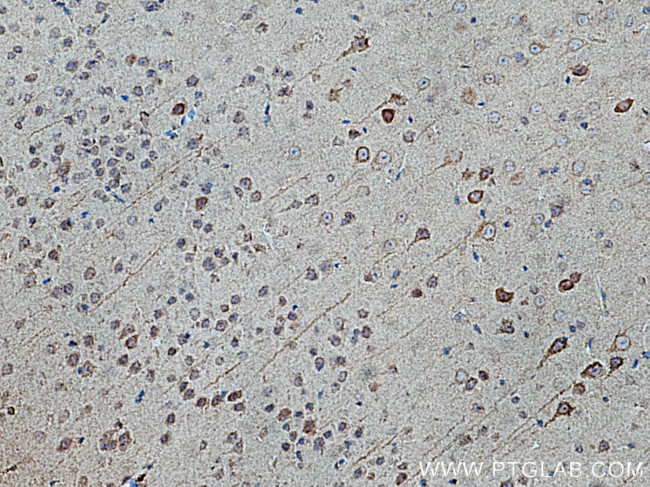 KIF5A Antibody in Immunohistochemistry (Paraffin) (IHC (P))