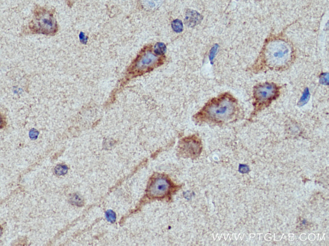 KIF5A Antibody in Immunohistochemistry (Paraffin) (IHC (P))