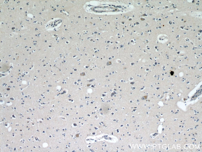 KIF5A Antibody in Immunohistochemistry (Paraffin) (IHC (P))