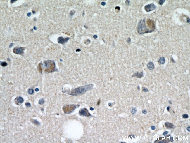 KIF5A Antibody in Immunohistochemistry (Paraffin) (IHC (P))