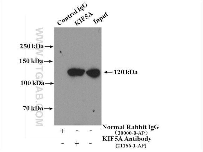 KIF5A Antibody in Immunoprecipitation (IP)