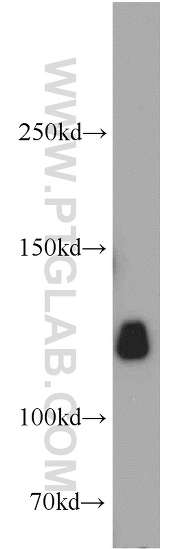 KIF5A Antibody in Western Blot (WB)