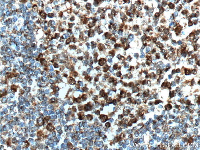 BCL6 Antibody in Immunohistochemistry (Paraffin) (IHC (P))