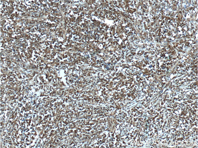 BCL6 Antibody in Immunohistochemistry (Paraffin) (IHC (P))