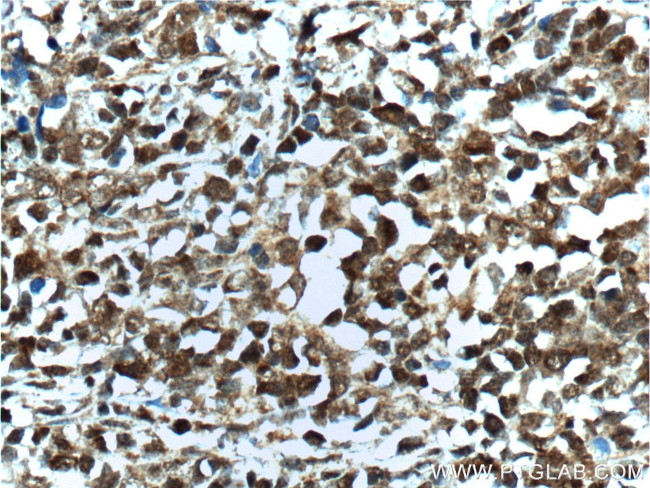 BCL6 Antibody in Immunohistochemistry (Paraffin) (IHC (P))