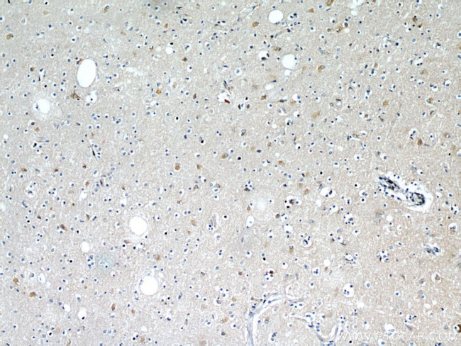 STIM2 Antibody in Immunohistochemistry (Paraffin) (IHC (P))