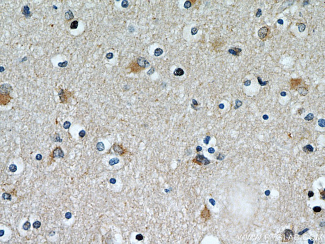 STIM2 Antibody in Immunohistochemistry (Paraffin) (IHC (P))