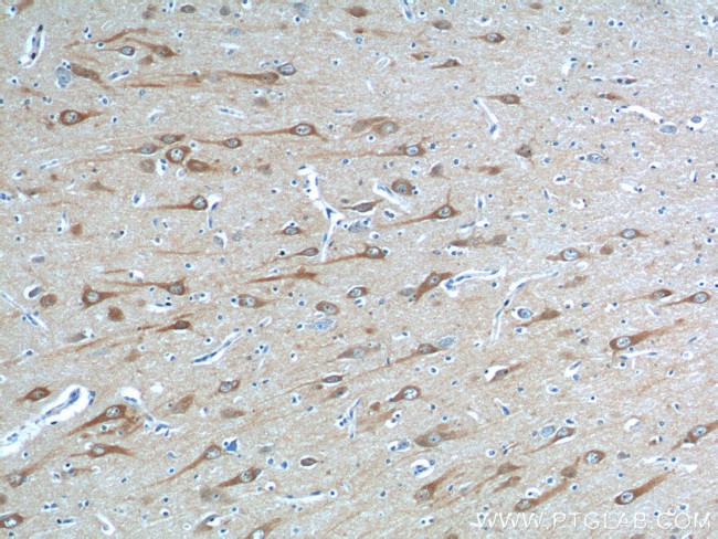 STIM2 Antibody in Immunohistochemistry (Paraffin) (IHC (P))