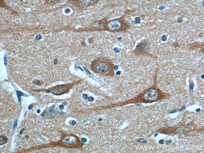 STIM2 Antibody in Immunohistochemistry (Paraffin) (IHC (P))