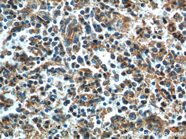 STIM2 Antibody in Immunohistochemistry (Paraffin) (IHC (P))