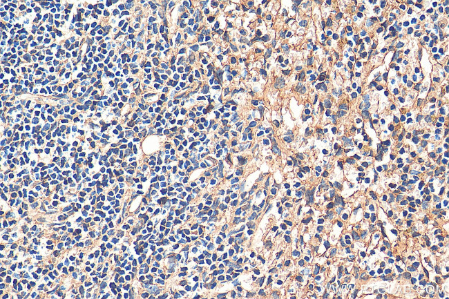 STIM2 Antibody in Immunohistochemistry (Paraffin) (IHC (P))