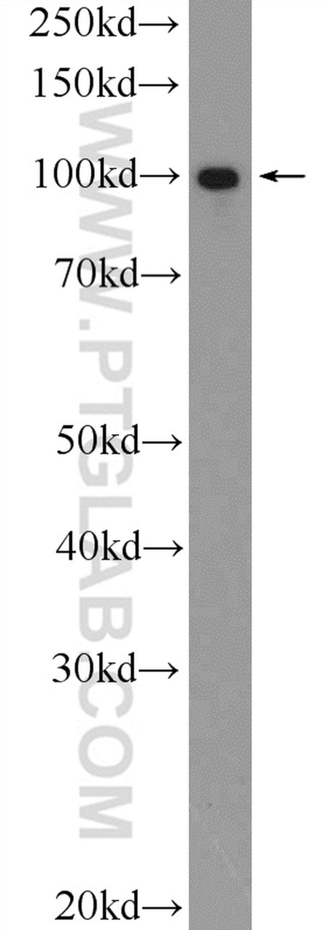 STIM2 Antibody in Western Blot (WB)