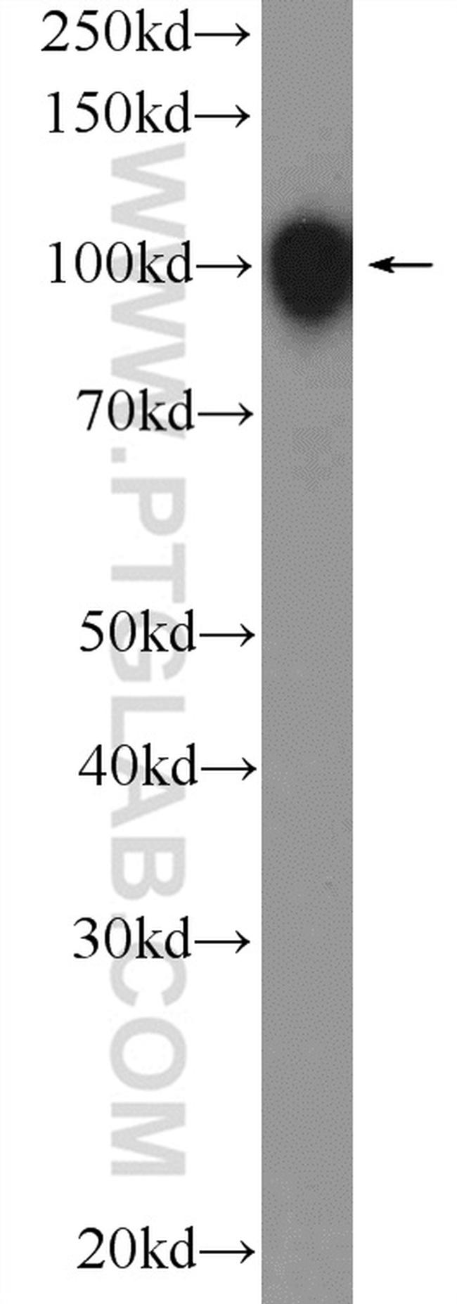 STIM2 Antibody in Western Blot (WB)