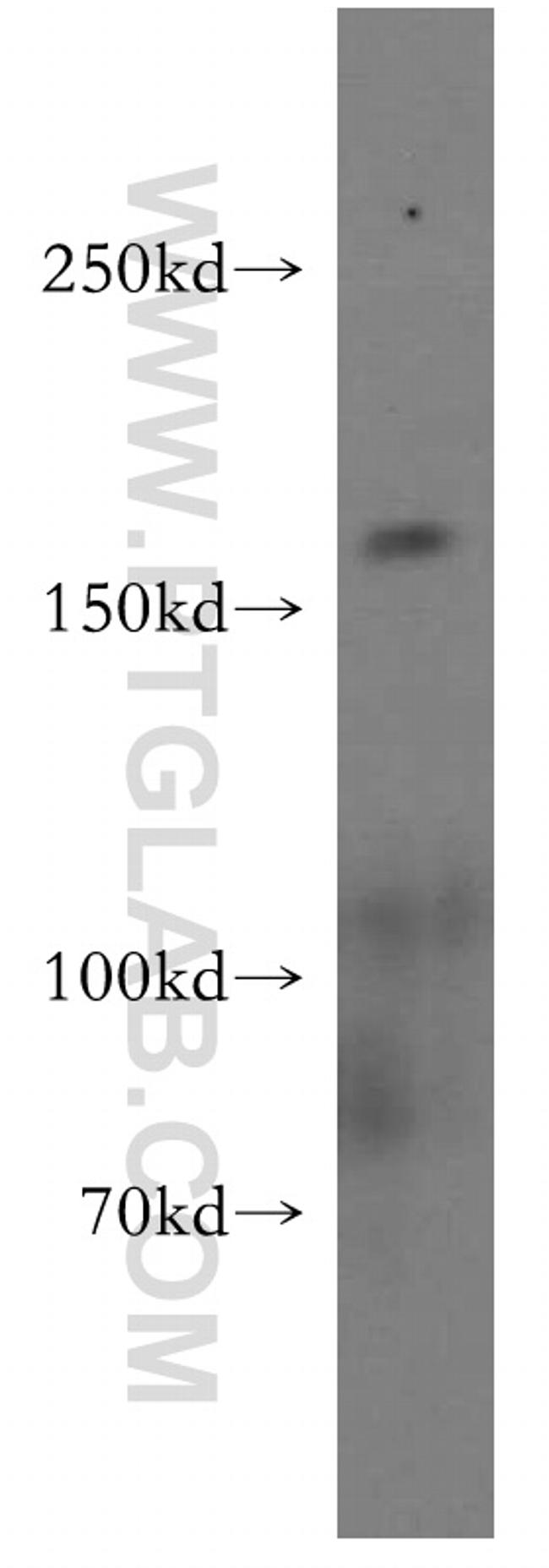 GOLGA3 Antibody in Western Blot (WB)