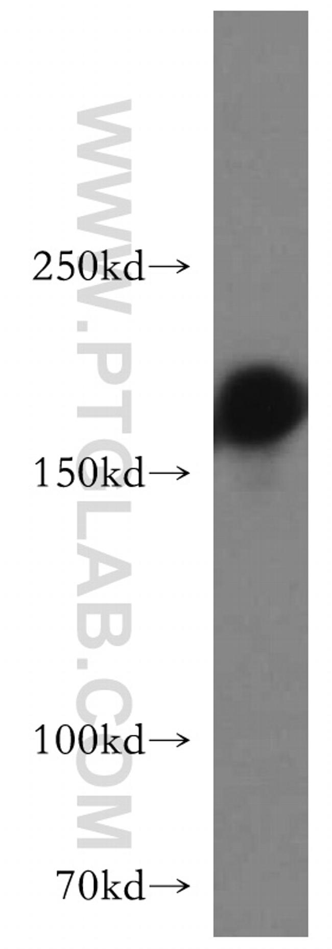 GOLGA3 Antibody in Western Blot (WB)
