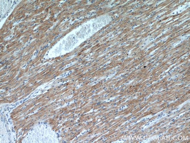 KLHL35 Antibody in Immunohistochemistry (Paraffin) (IHC (P))