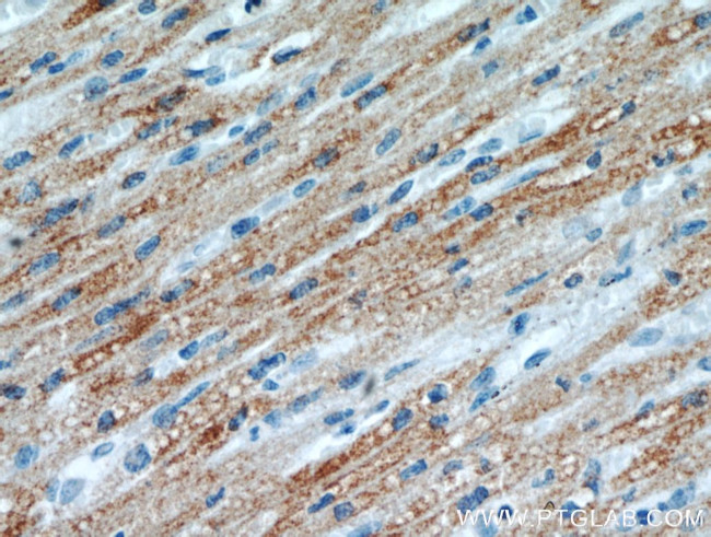 KLHL35 Antibody in Immunohistochemistry (Paraffin) (IHC (P))