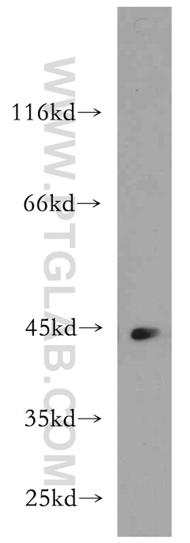 KLHL35 Antibody in Western Blot (WB)