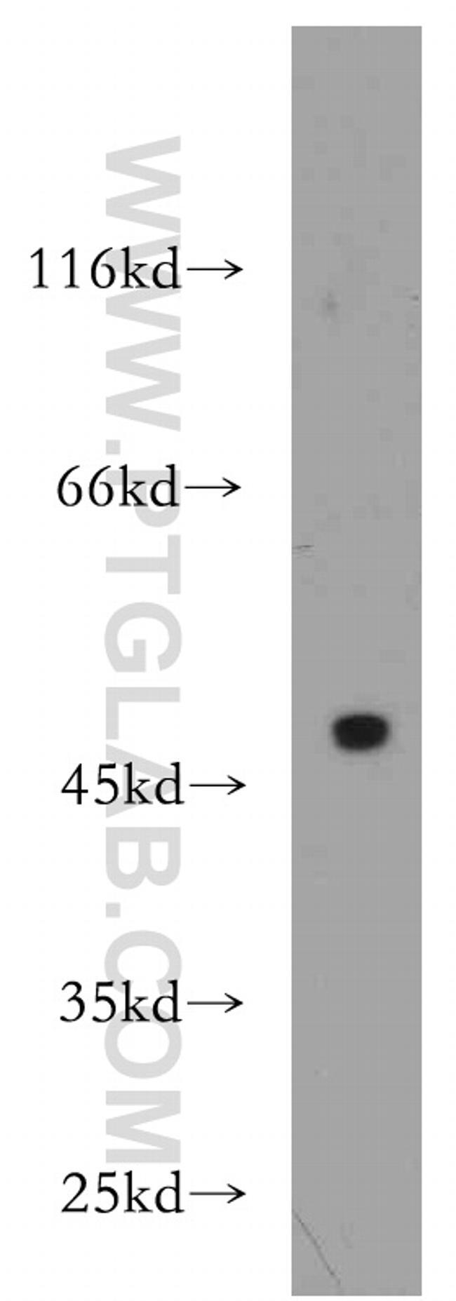 KLHL35 Antibody in Western Blot (WB)