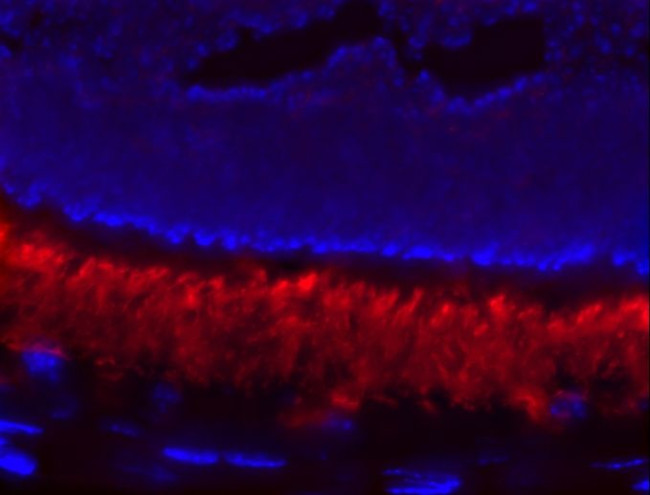 PDE6A Antibody in Immunohistochemistry (IHC)